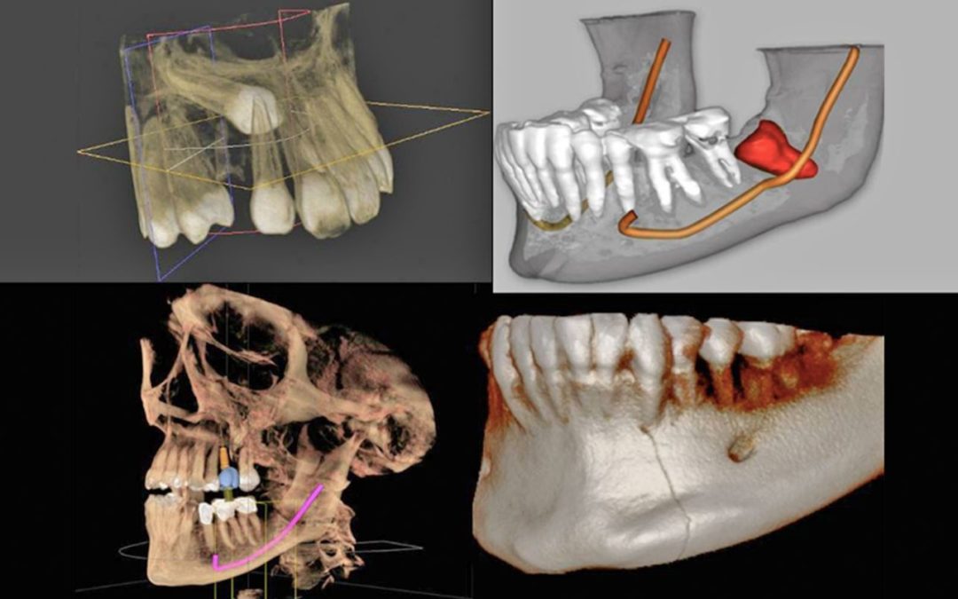 Curso CBCT Escáner Dental